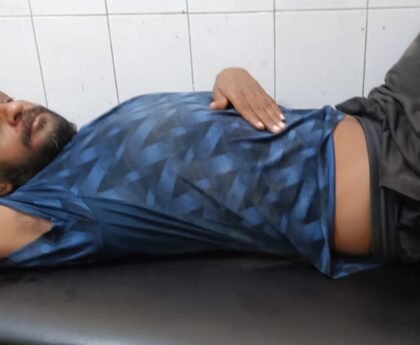 तेज रफ्तार बाइक की टक्कर से दो लोग घायल, जिला अस्पताल रेफर