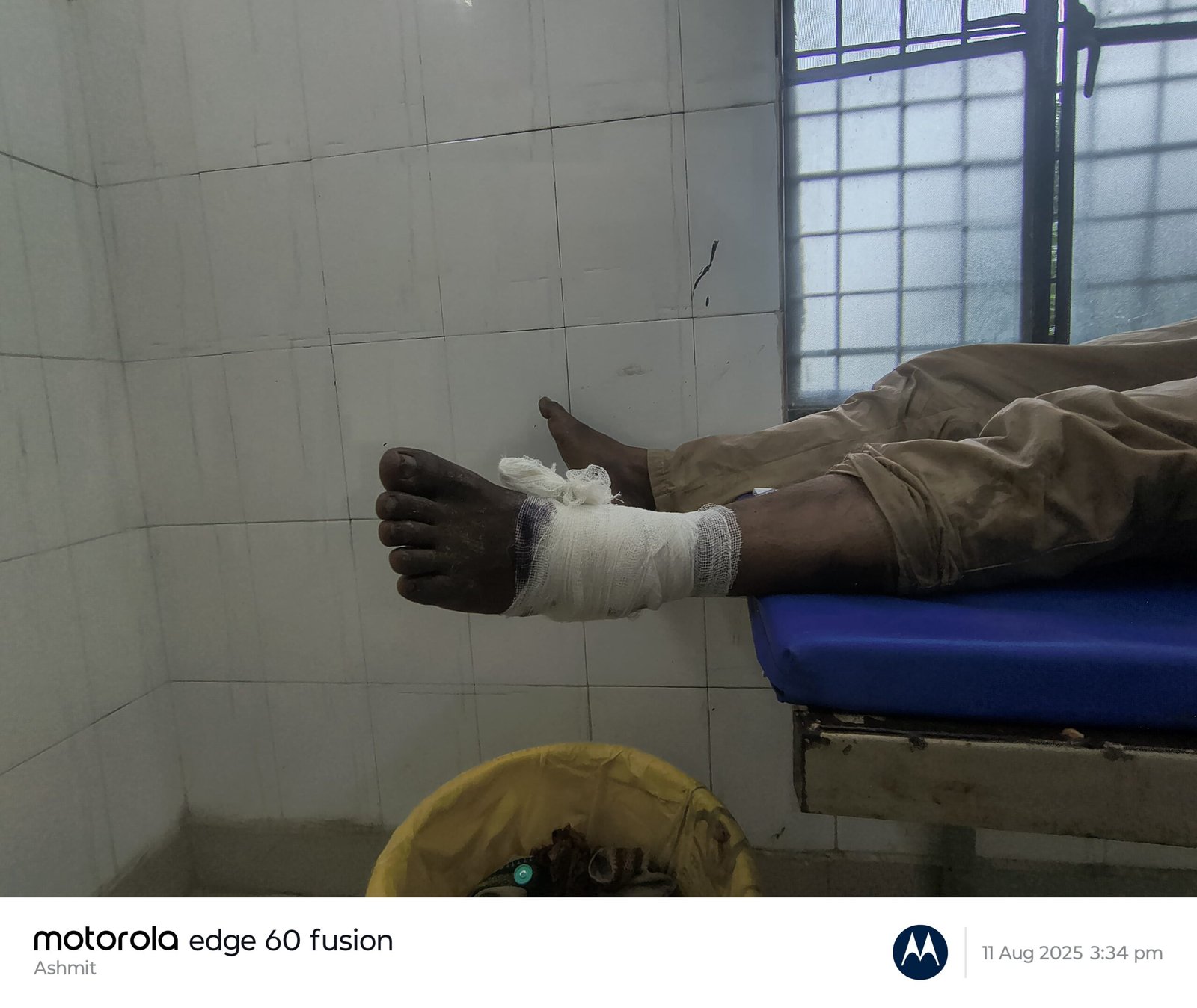 कुसौरा बाजार के पास छात्रा को बचाने में हादसा, रमेश अग्रहरि गंभीर रूप से घायल