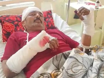 रॉड, कुल्हाड़ी से अधेड़ पर हमला:पुलिस कार्रवाई न होने पर पीड़ित परिवार ने एसपी से की शिकायत